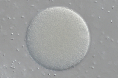 Fécondation chez l'Oursin x150